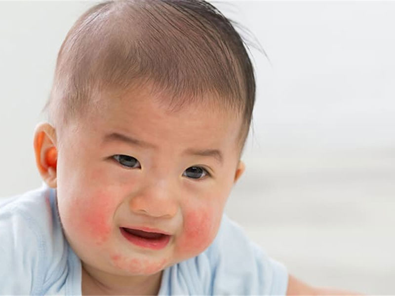 Hormone and Anti-Infective Drug Test for Children'S Skin Care Products