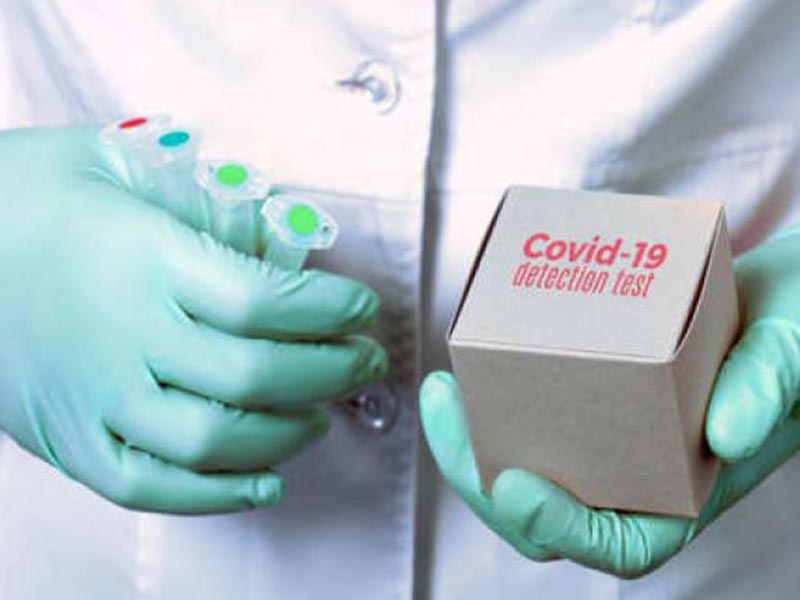 Novel Coronavirus Nucleic Acid Detection