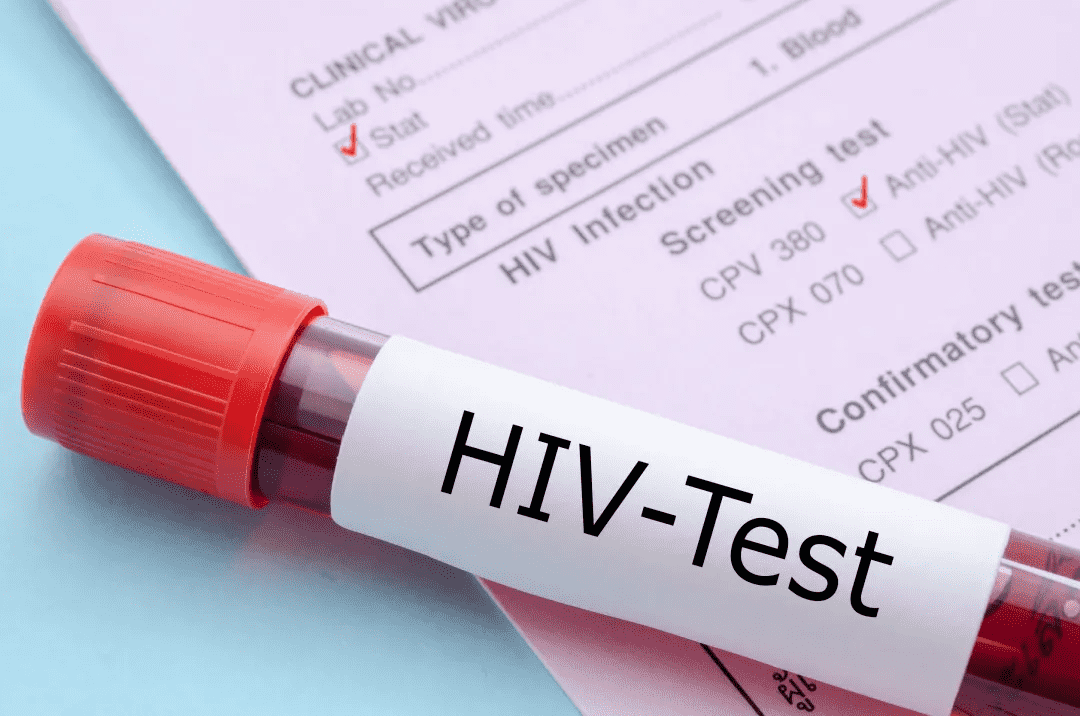 CTI华测艾普获得HIV检测实验室资质，聚焦大众健康助力疾病防控