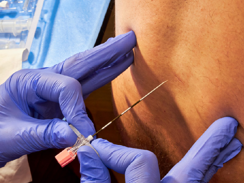 神经阻滞穿刺针注册检测