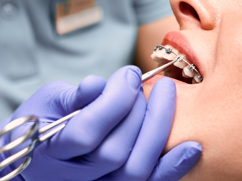 正畸丝注册检测