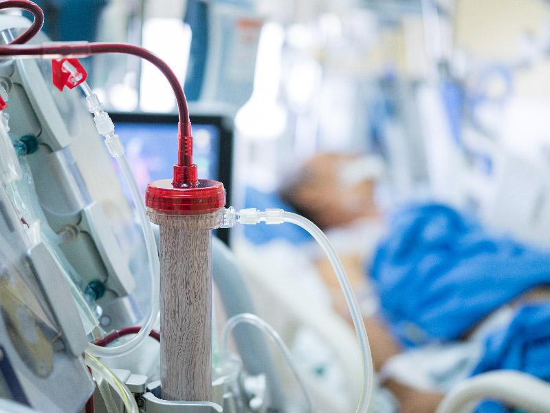 胆红素血浆吸附器检测