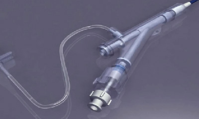 医械科普丨泌尿通道的精准引路人：一次性使用输尿管导引鞘