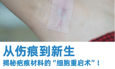医械科普丨从伤痕到新生：揭秘疤痕材料的“细胞重启术”！